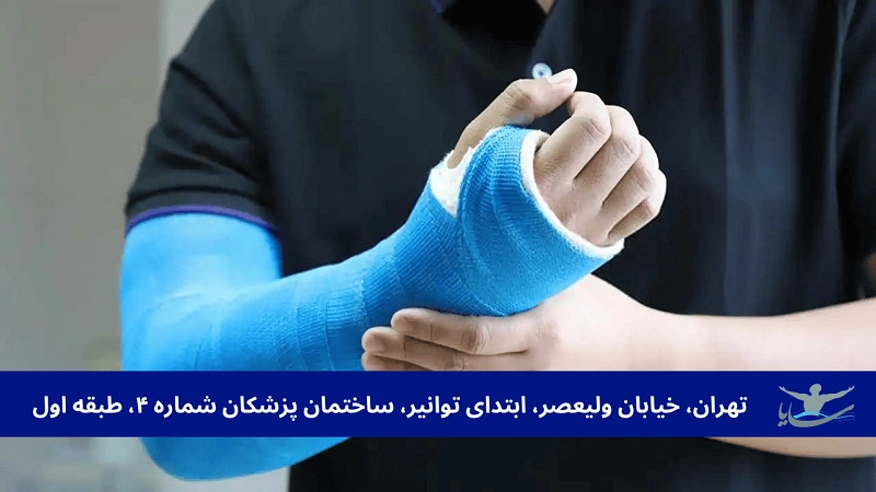 گام به گام تا درمان کامل شکستگی استخوان