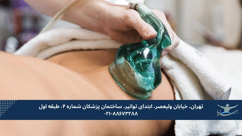 4. مراحل وکیوم تراپی و نحوه انجام آن