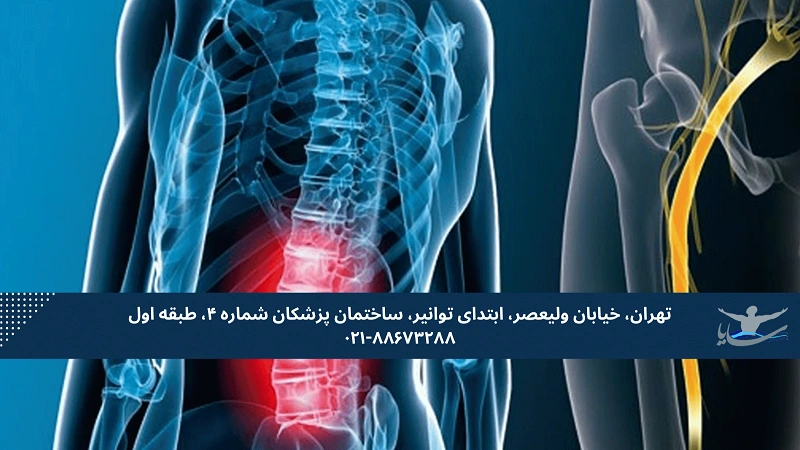 تفاوت_های کلیدی بین دیسک کمر و سیاتیک
