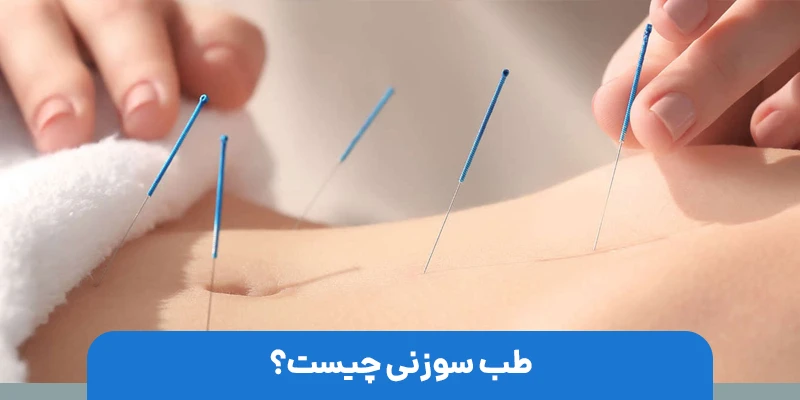 عوارض و خطرات احتمالی طب سوزنی