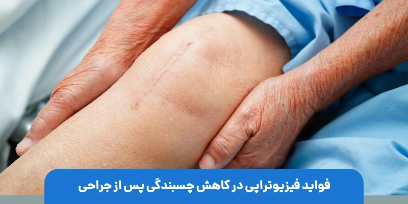 فواید فیزیوتراپی در کاهش چسبندگی پس از جراحی