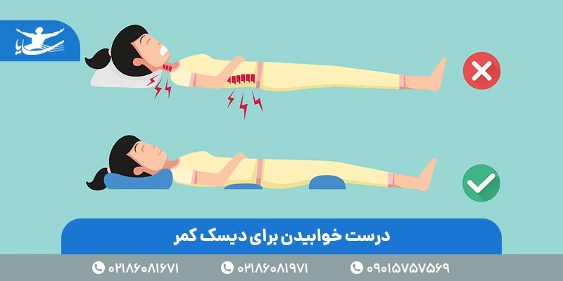 عکس درست خوابیدن برای دیسک کمر