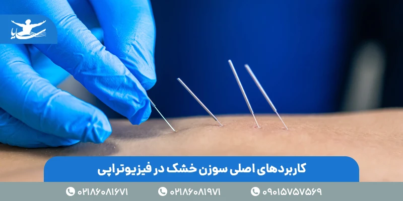 کاربردهای اصلی سوزن خشک در فیزیوتراپی🩺