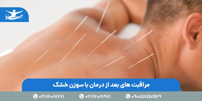 مراقبت های بعد از درمان با سوزن خشک