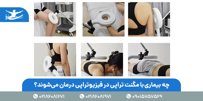 چه بیماری با مگنت تراپی در فیزیوتراپی درمان میشوند؟