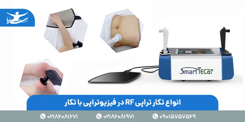 انواع تکار تراپی RF در فیزیوتراپی با تکار