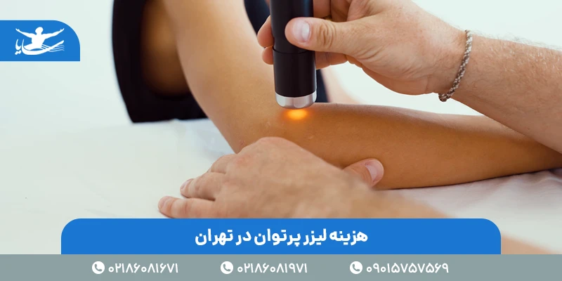 هزینه لیزر پرتوان در تهران