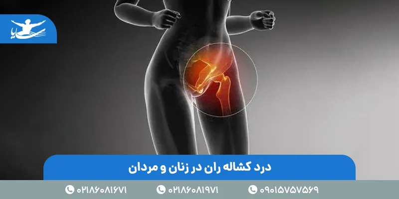 درد کشاله ران در زنان و مردان